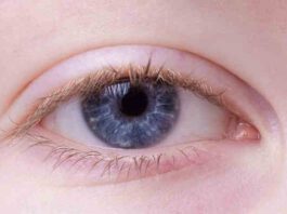Dermatite atopica occhi bambini