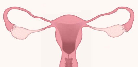 ectopia utero