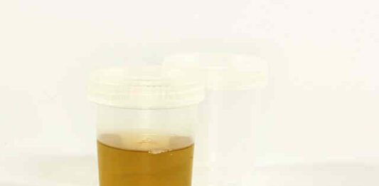 batteriuria nelle urine