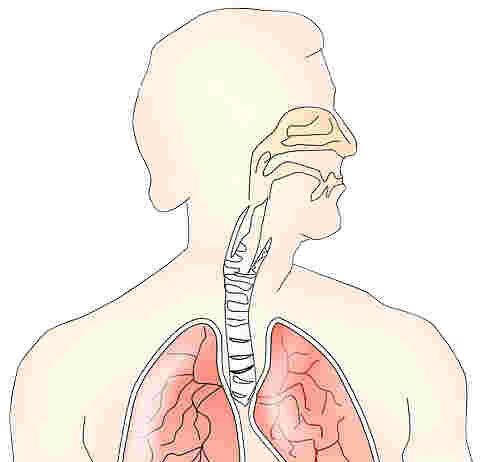 noduli polmonari multipli