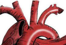 angina instabile cause