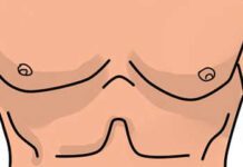 angina addominale sintomi